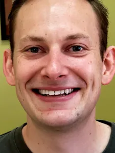 Picture of a man smiling for the smile gallery after  treatment