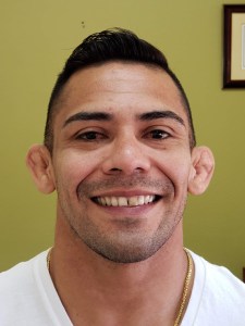 Picture of a man smiling for the smile gallery before  treatment