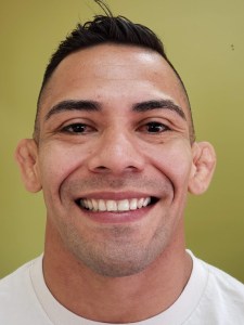 Picture of a man smiling for the smile gallery after  treatment