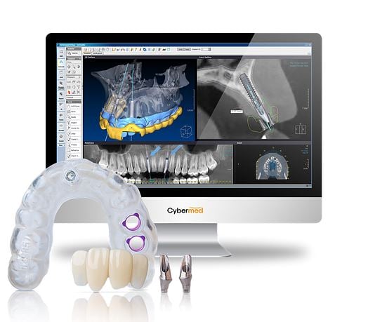 screen with x-ray, dental implant models