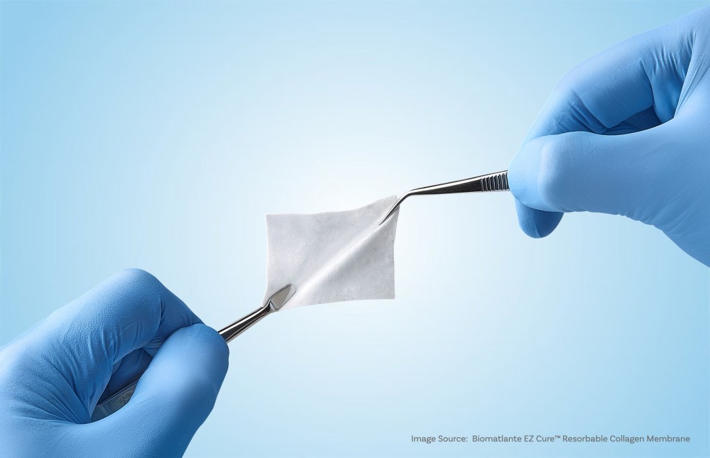 collagen membrane sample held with tweezers