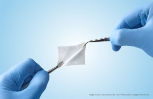 collagen membrane sample held with tweezers
